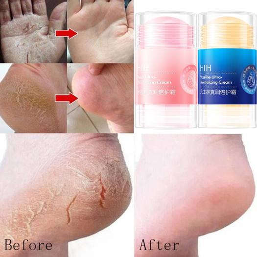 Cream for cracked hands and feet