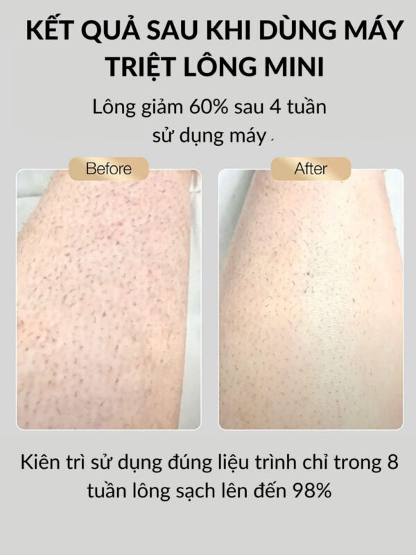 Mini hair removal machine, 5-level permanent hair removal with IPL technology